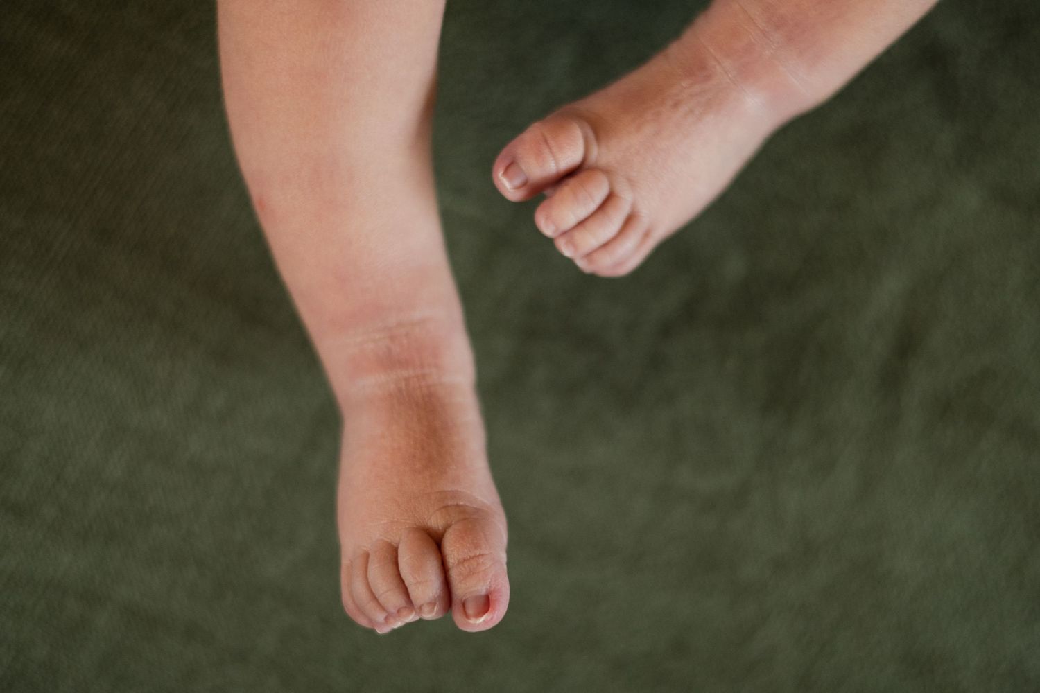Close-up of a baby's tiny feet and toes resting on a green textured background.