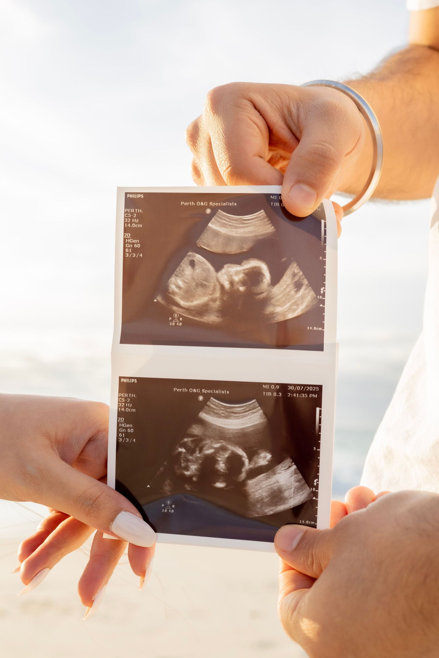 Couple holding ultrasound photos at the beach during a maternity photoshoot.