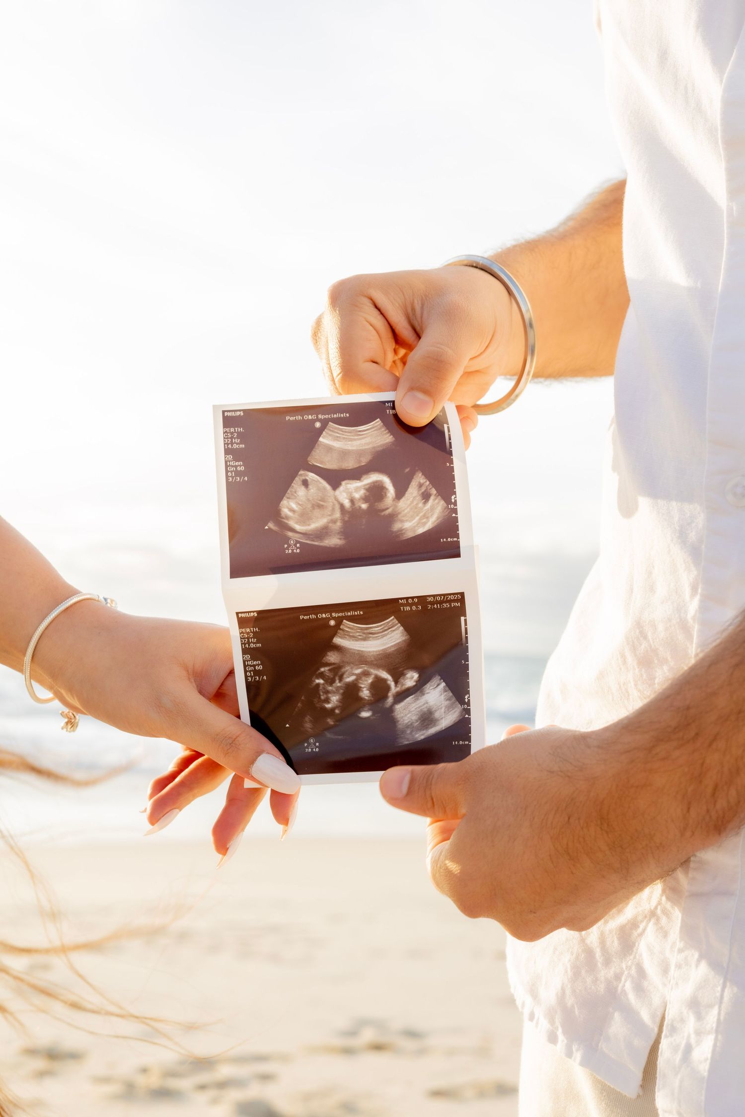 Expectant parents displaying baby ultrasound images together on a sunny beach.