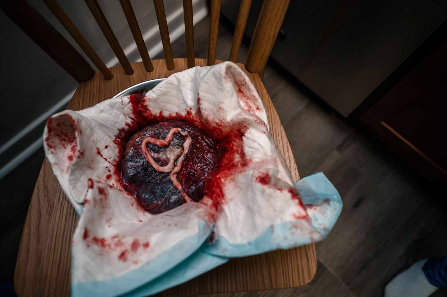 Heart shaped Placenta On A Disposable Chux Pad In A Bowl